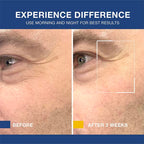 Men'S Face Moisturizer: anti Aging Cream, Wrinkles Cream, Hyaluronic Moisture, Skincare, Comfort ,Moisturizing ,Hydrating,
